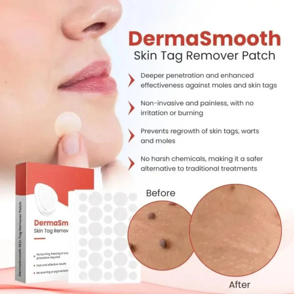 DermaSmooth Skin Tag, Mole Remover Patch | Nano-Microneedle | 72 Patches